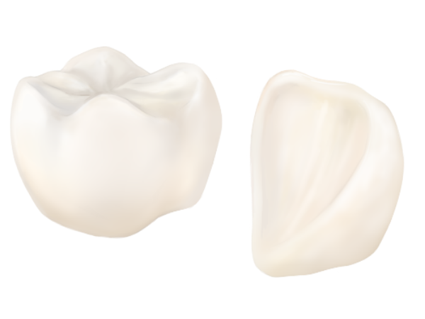 清藤歯科医院－審美歯科