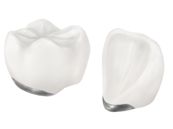 清藤歯科医院－審美歯科