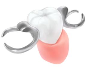 清藤歯科医院－入れ歯・義歯