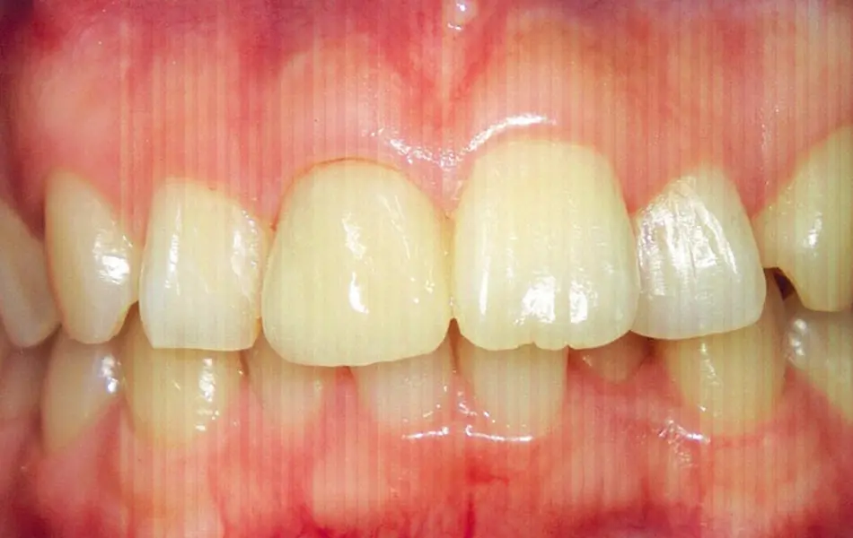 清藤歯科医院－審美歯科