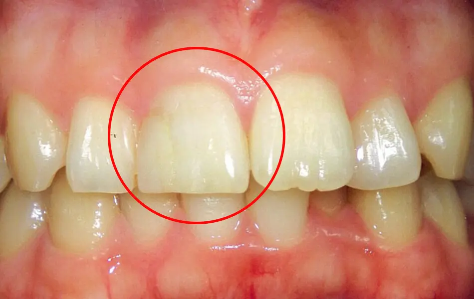 清藤歯科医院－審美歯科