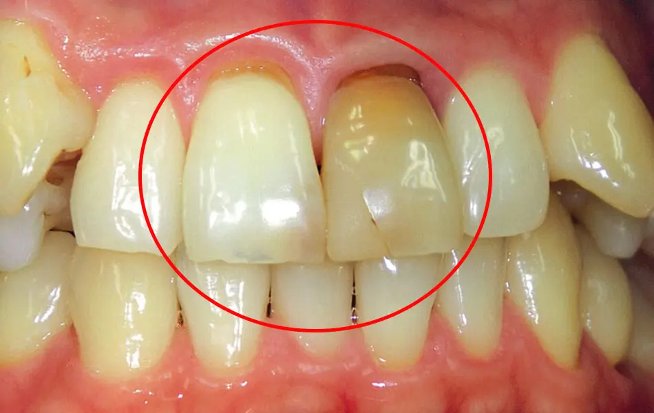 清藤歯科医院－審美歯科