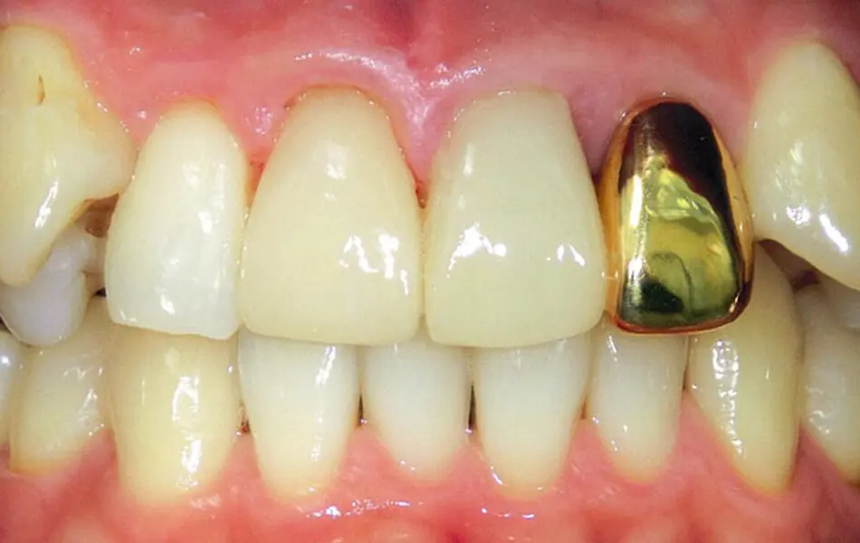 清藤歯科医院－審美歯科