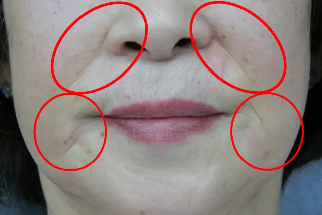 清藤歯科医院－デンタルエステ