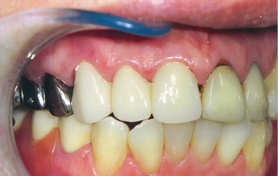 清藤歯科医院－審美歯科