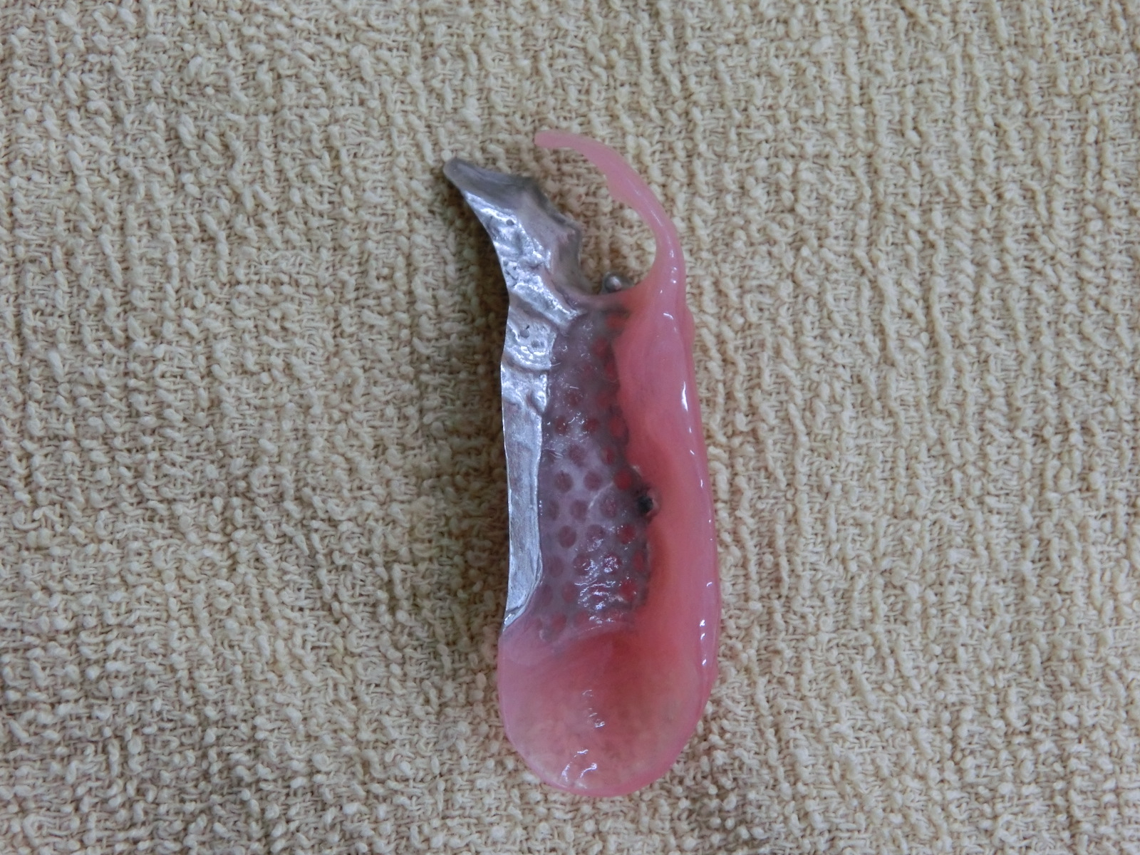 清藤歯科医院-入れ歯・義歯-コンビネーションデンチャー