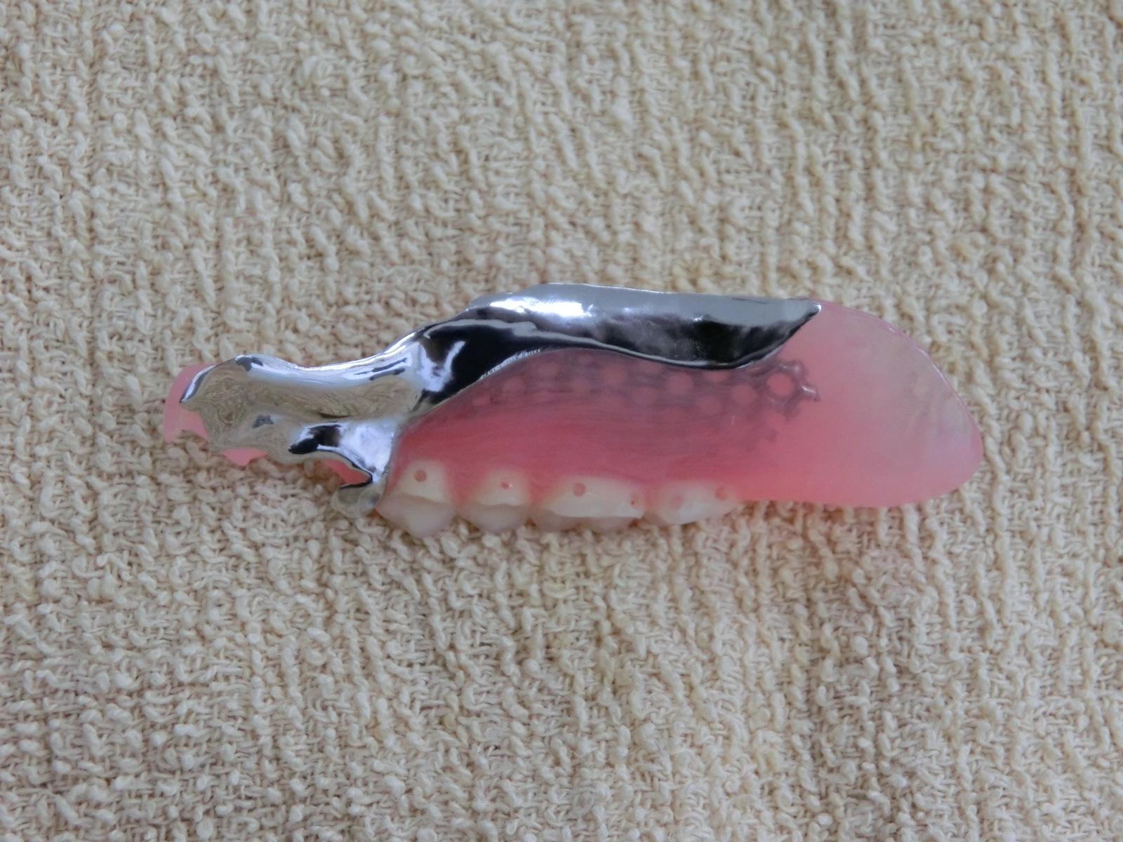 清藤歯科医院-入れ歯・義歯-コンビネーションデンチャー