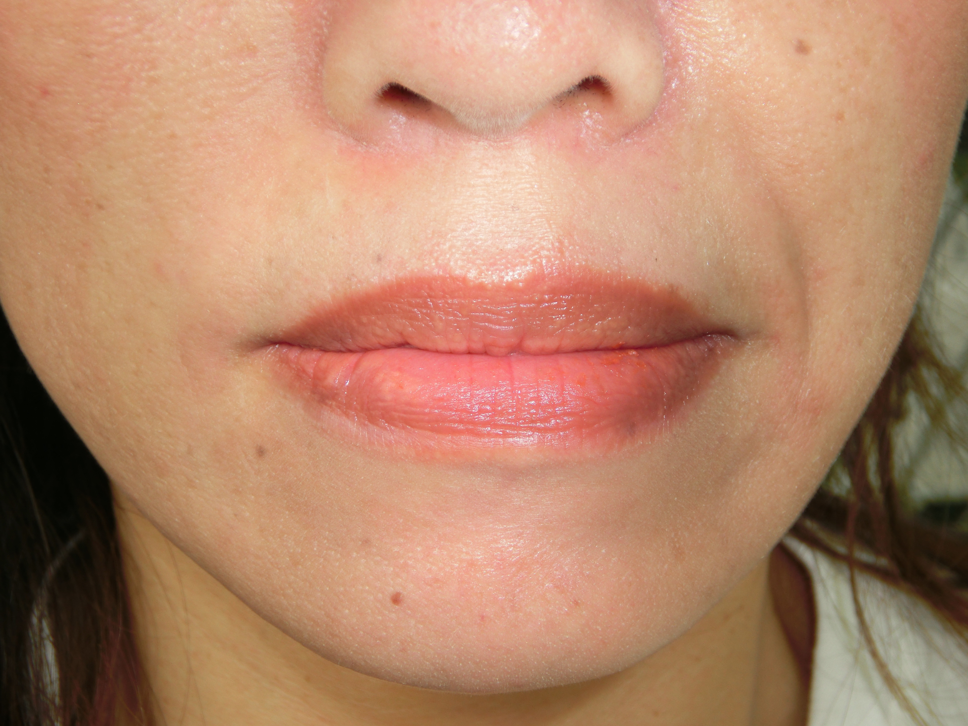 清藤歯科医院-デンタルエステ