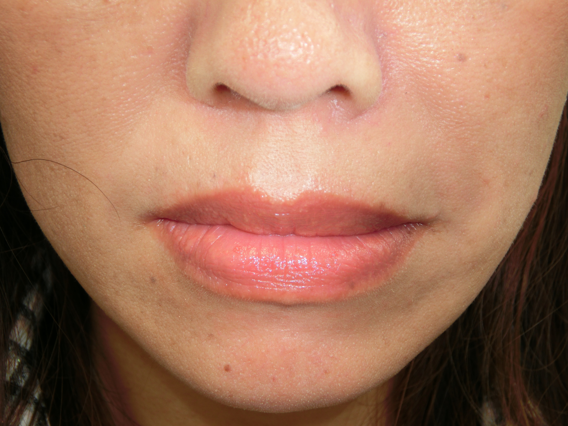 清藤歯科医院-デンタルエステ