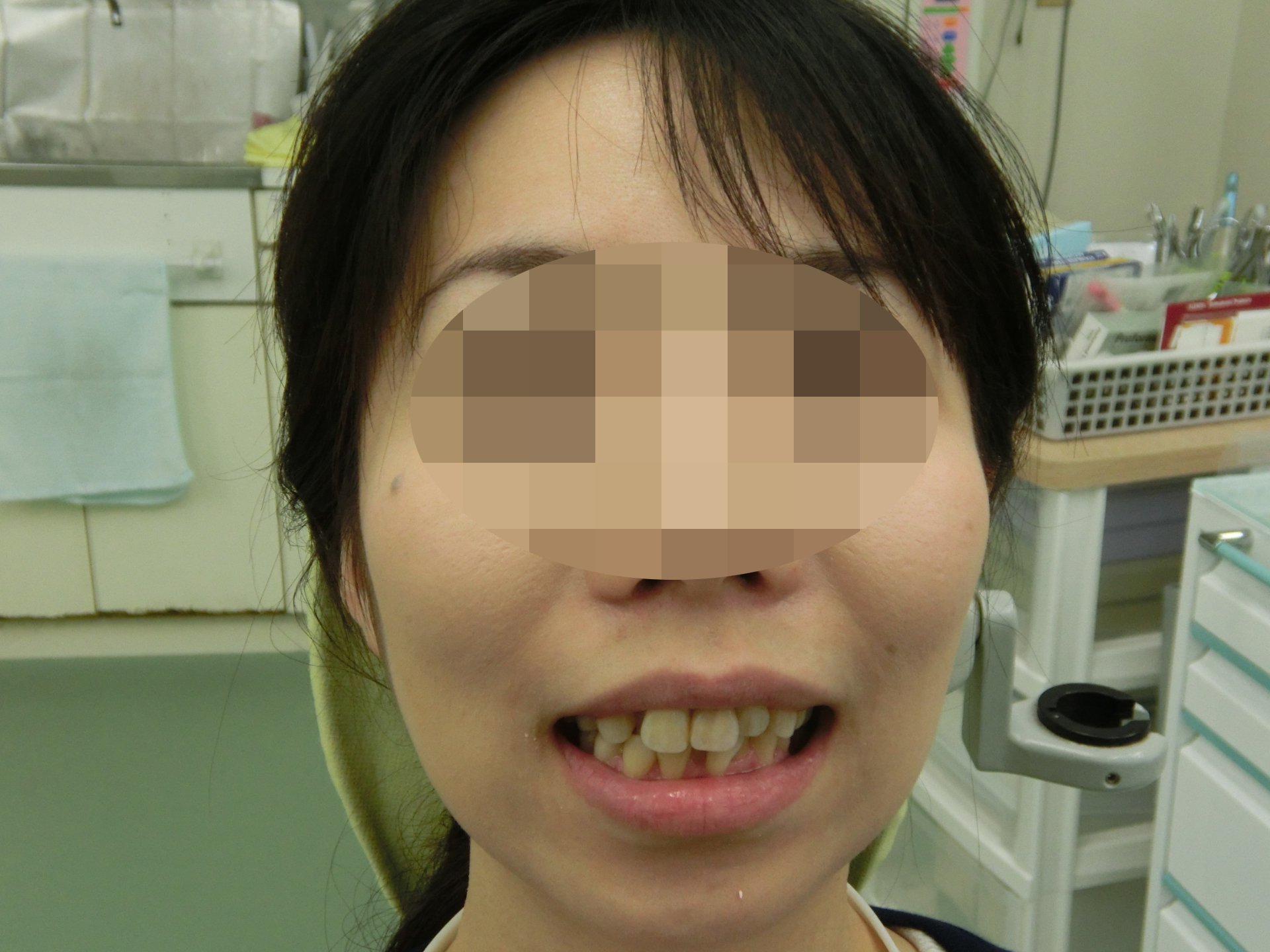 清藤歯科医院-矯正歯科