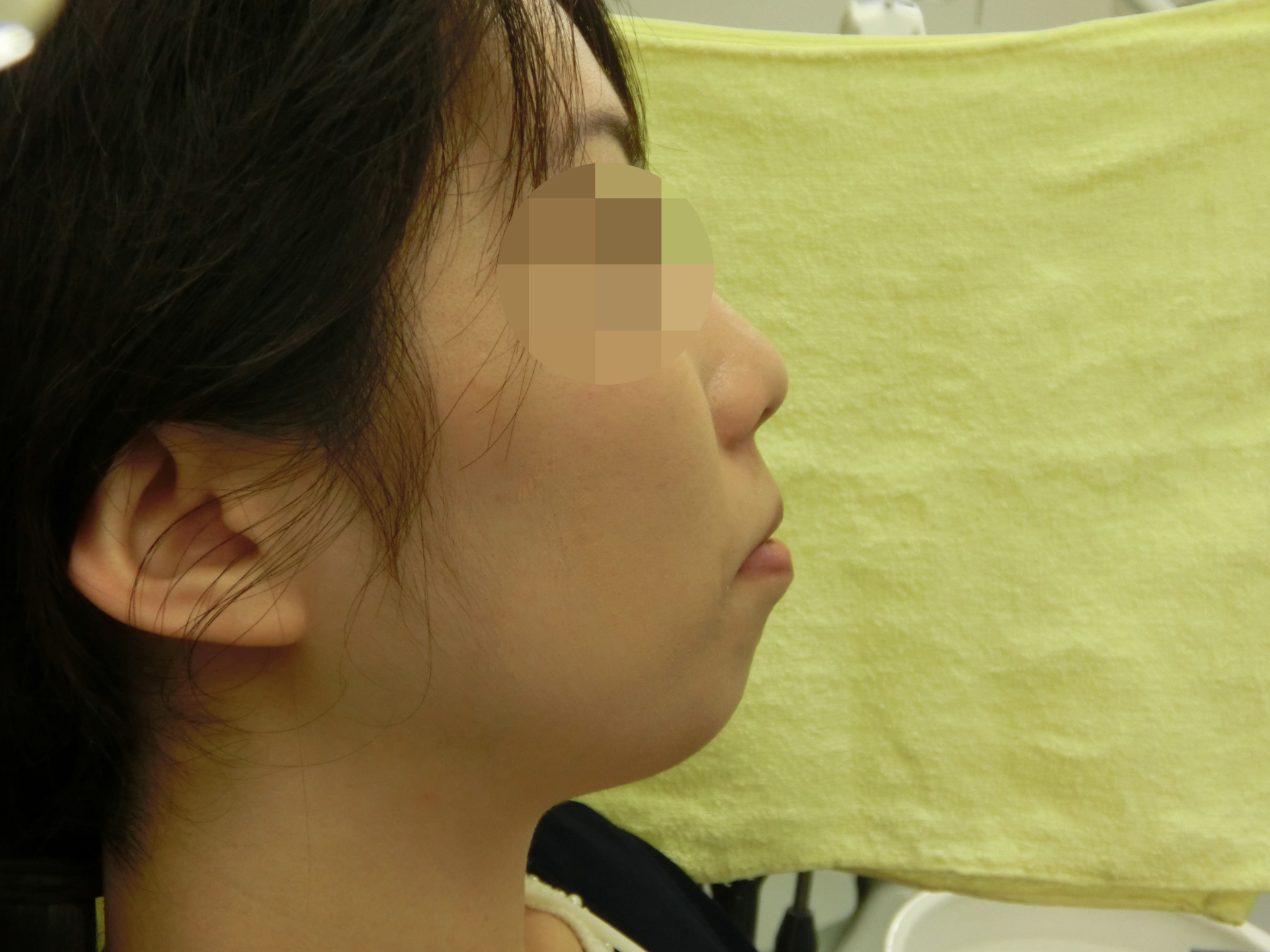 清藤歯科医院-矯正歯科