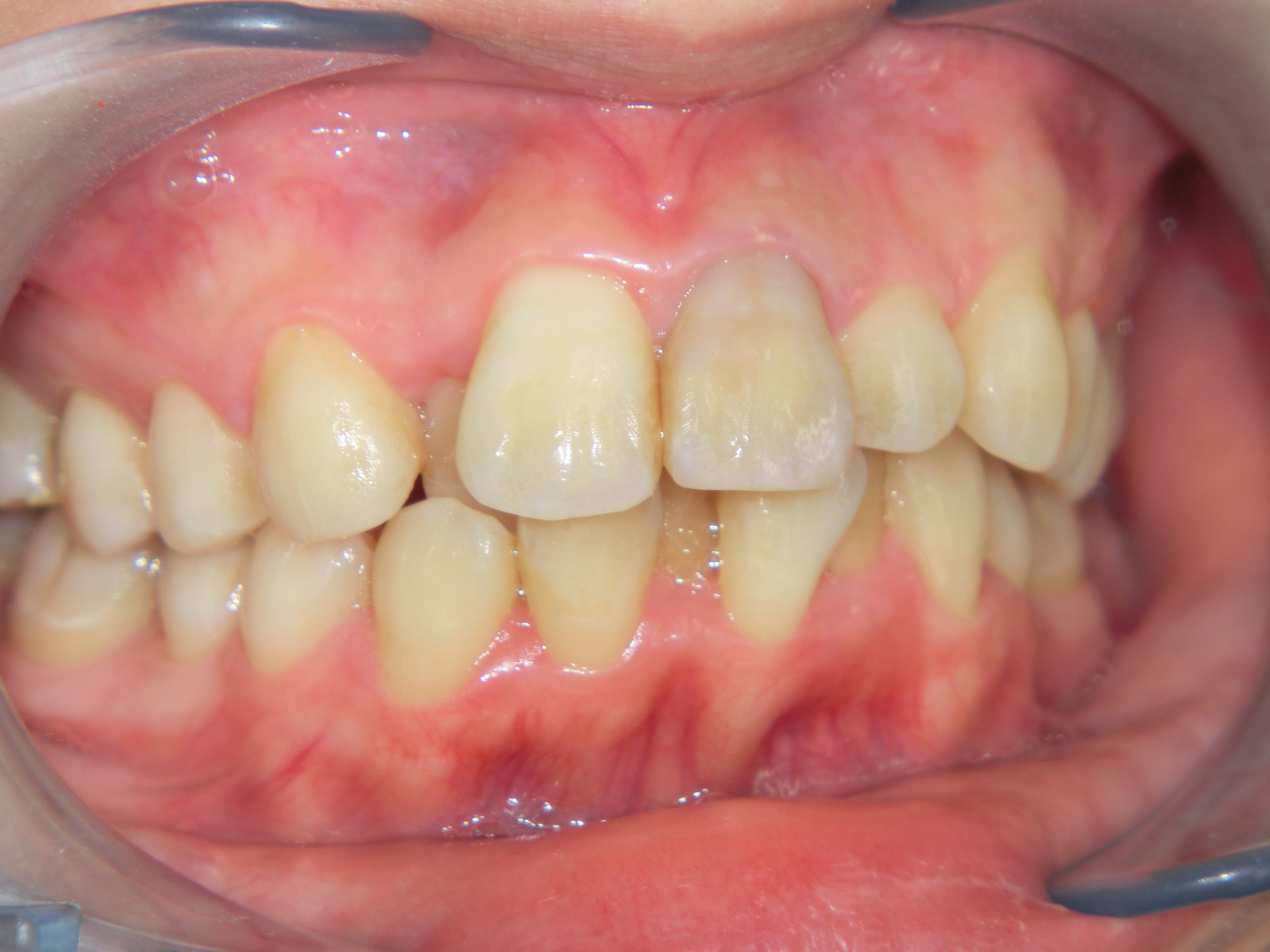 清藤歯科医院-矯正歯科