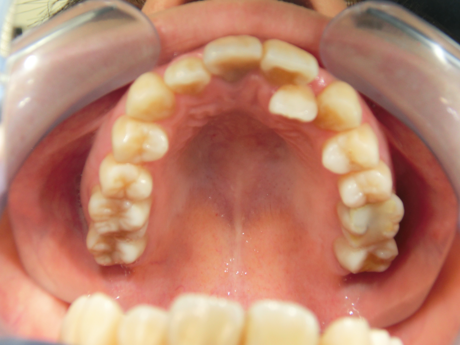 清藤歯科医院-矯正歯科