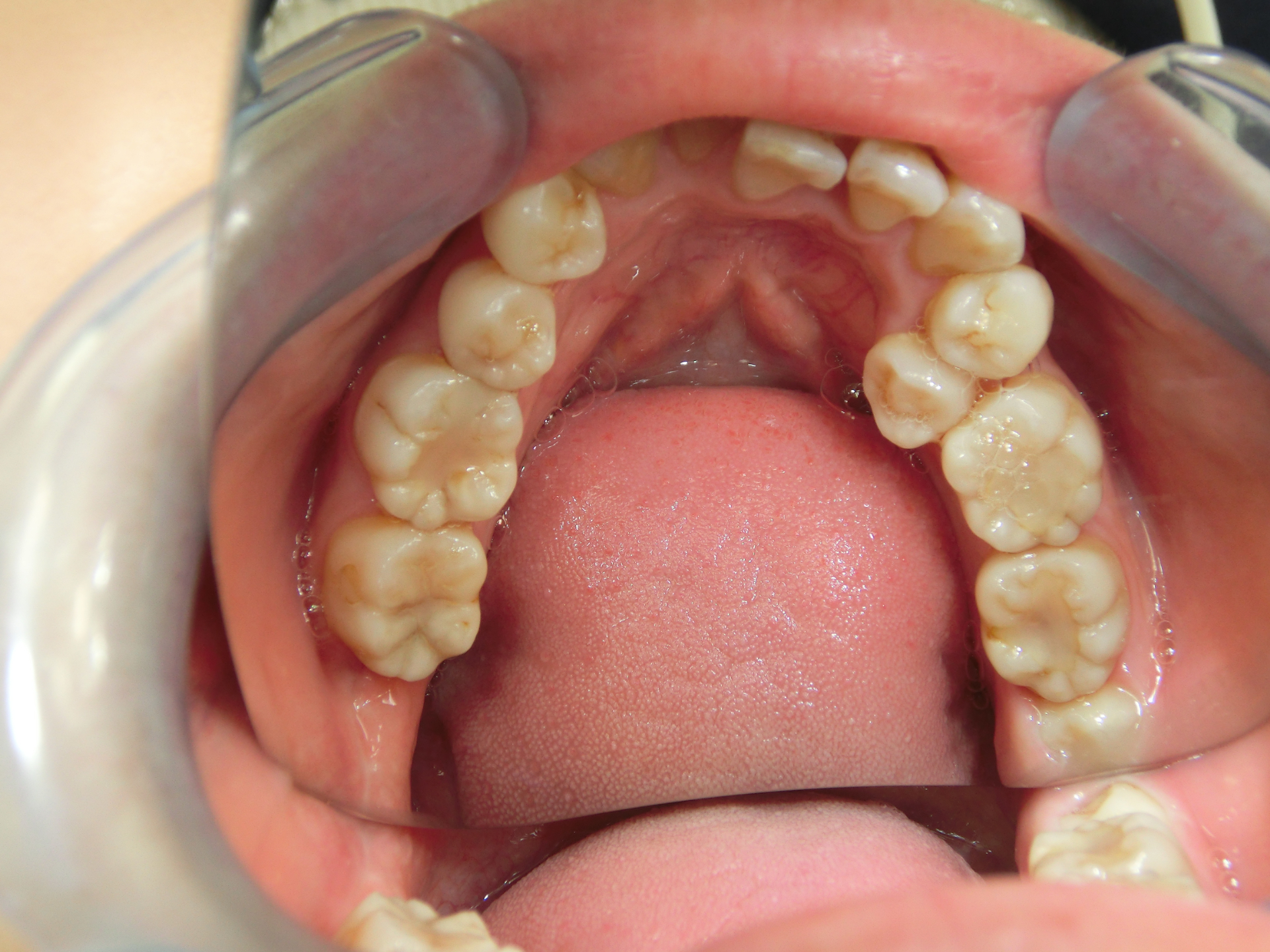 清藤歯科医院-矯正歯科