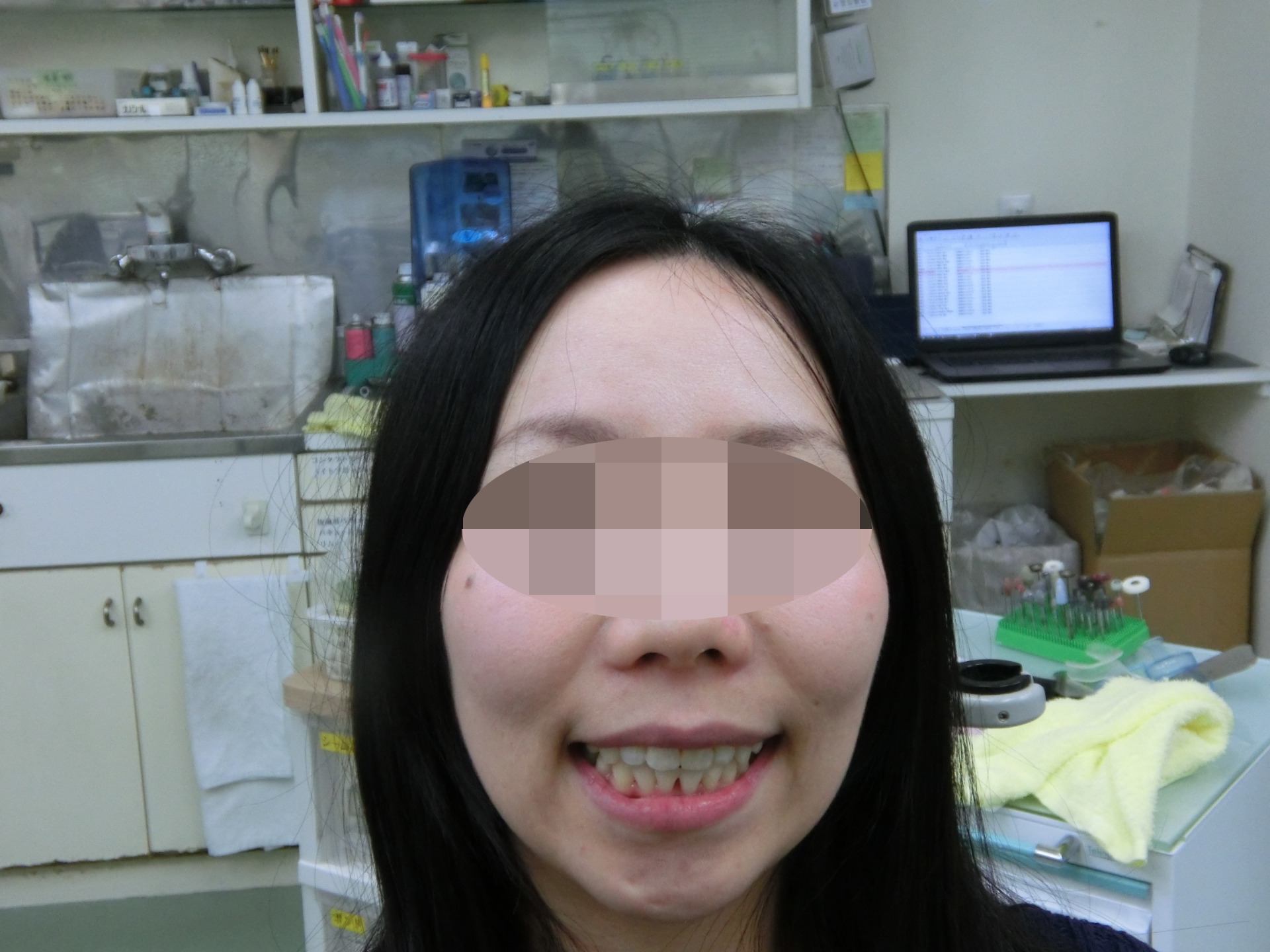 清藤歯科医院-矯正歯科