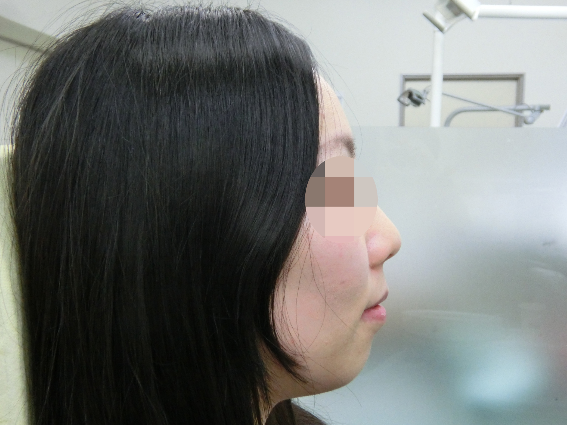 清藤歯科医院-矯正歯科