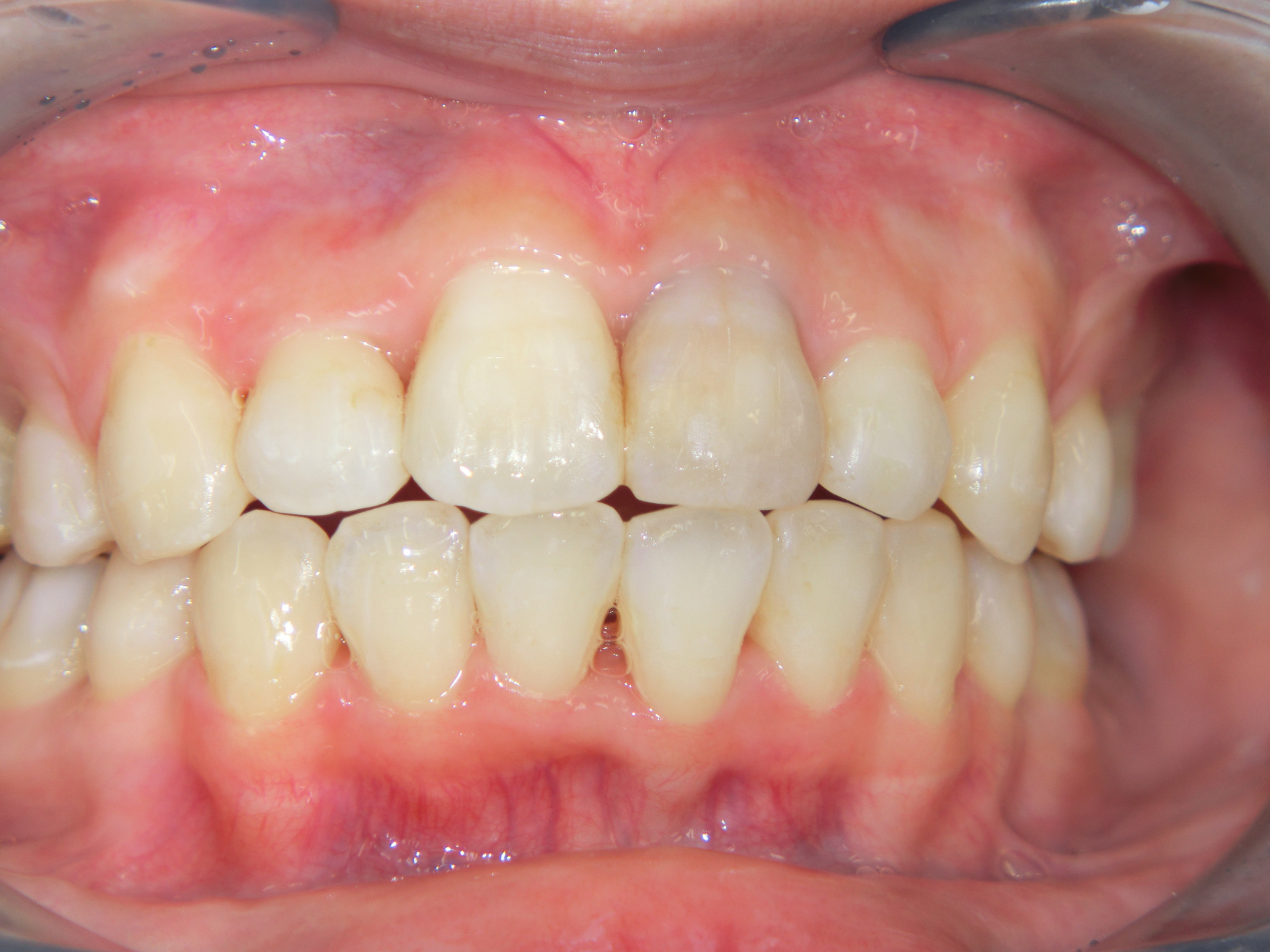 清藤歯科医院-矯正歯科