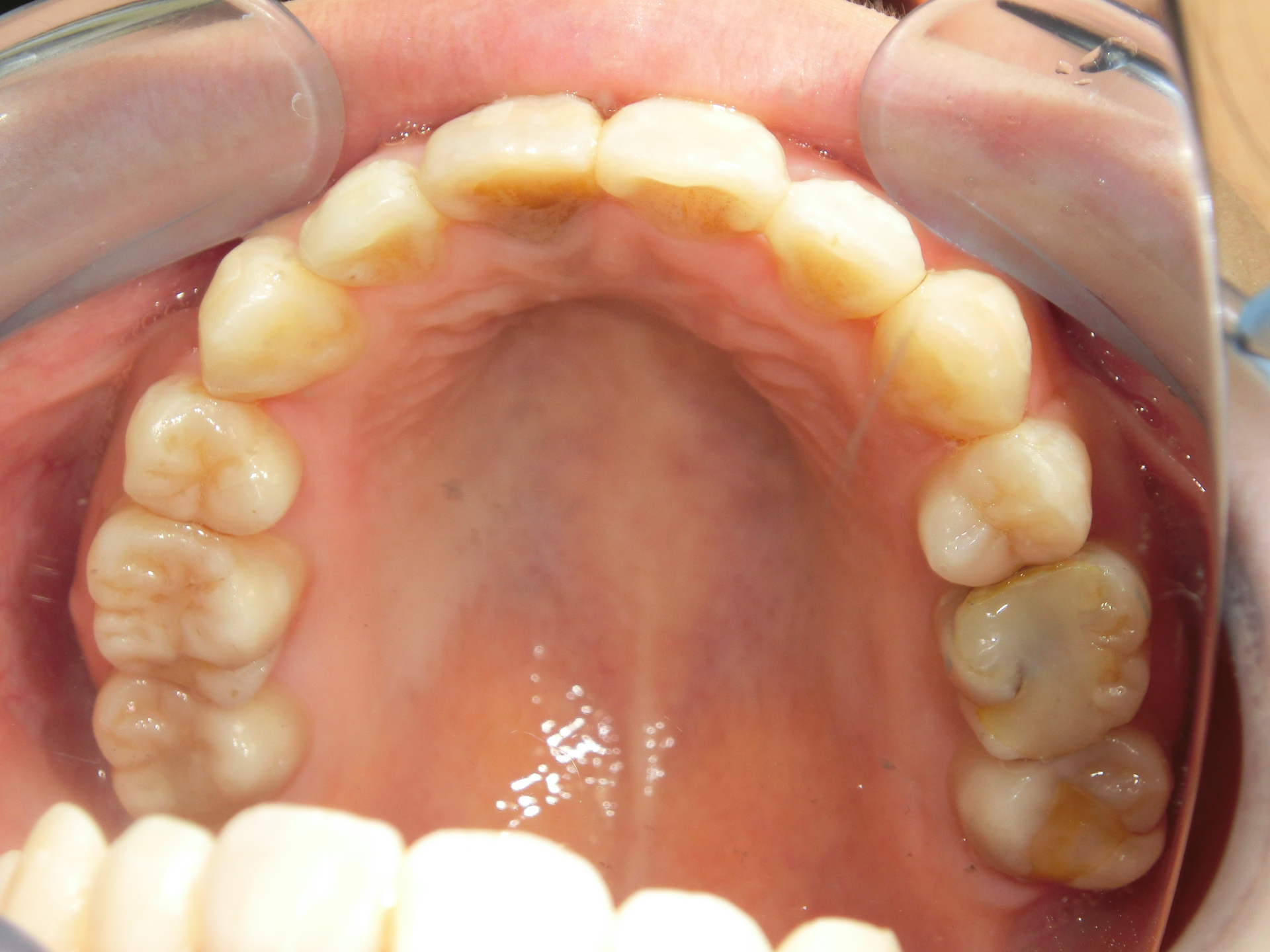 清藤歯科医院-矯正歯科