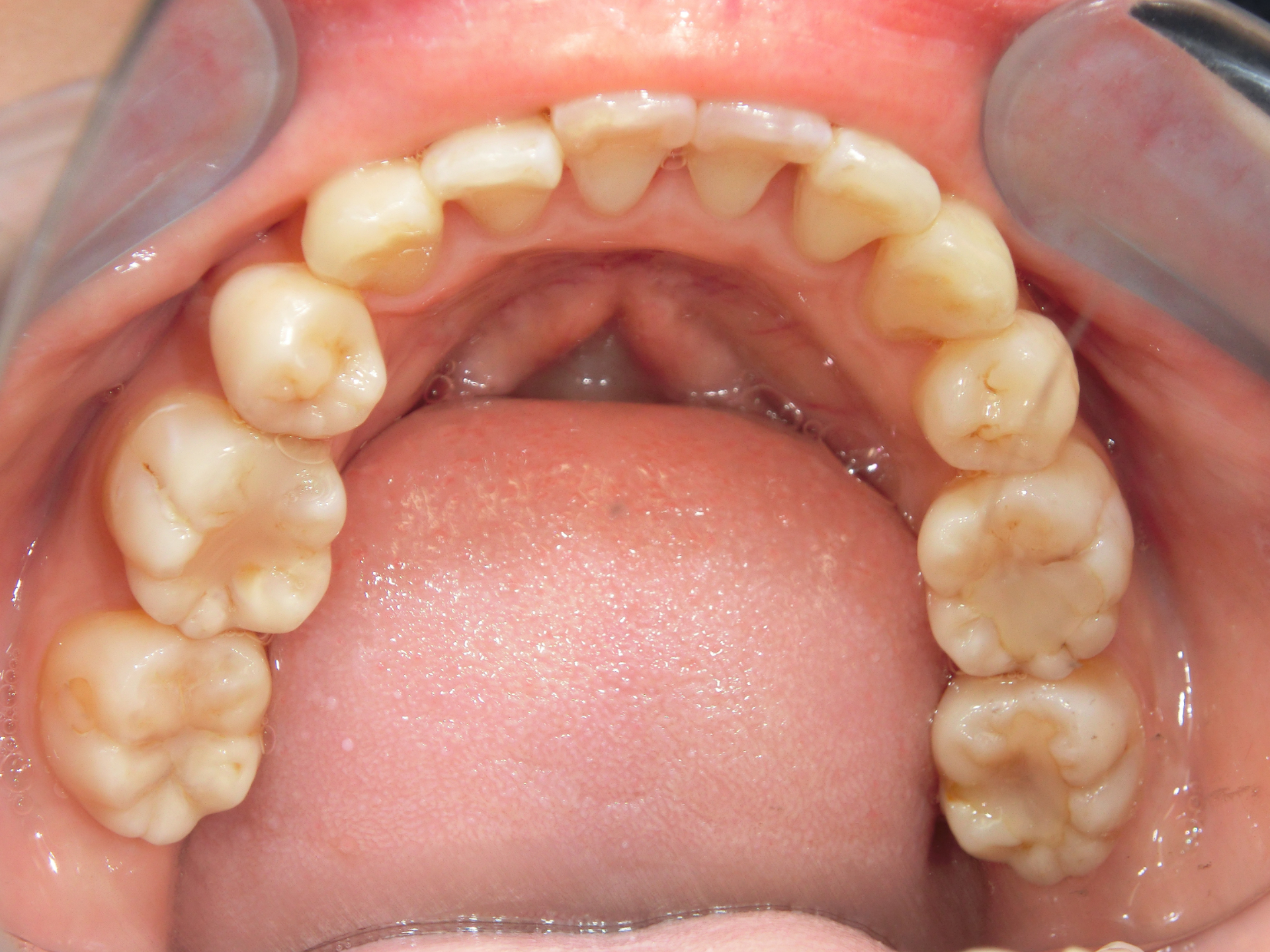 清藤歯科医院-矯正歯科