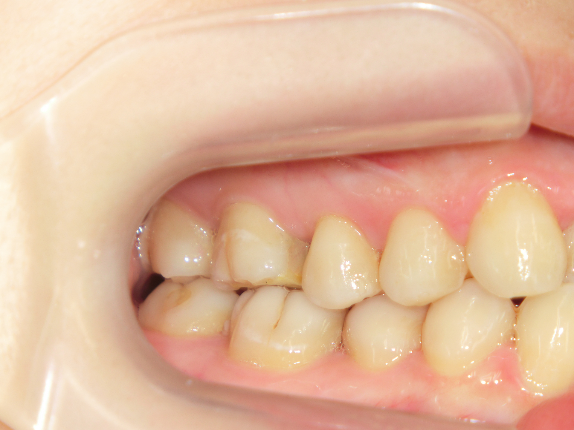 清藤歯科医院-矯正歯科