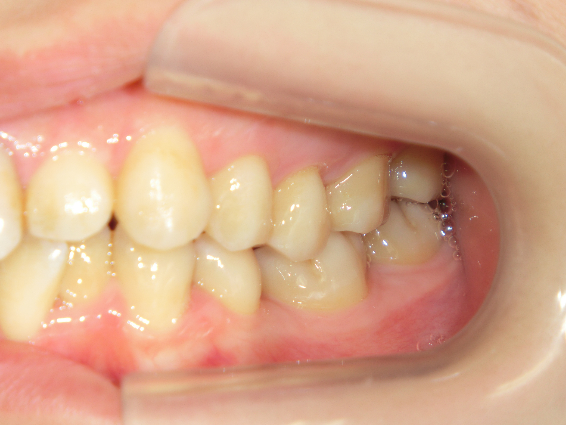 清藤歯科医院-矯正歯科