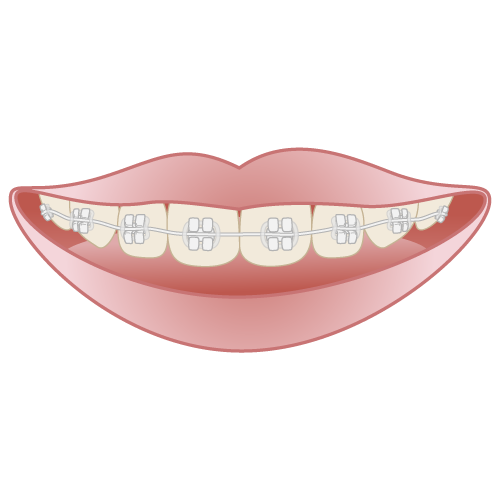 清藤歯科医院－矯正歯科