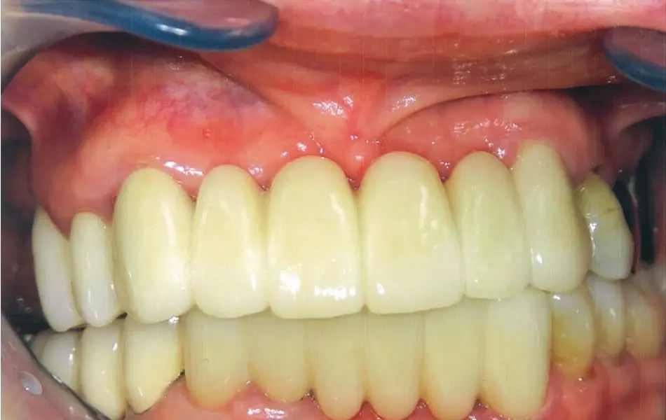 清藤歯科医院－審美歯科