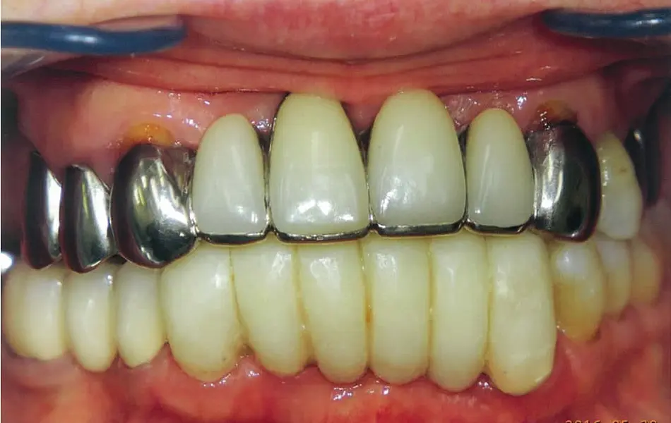 清藤歯科医院－審美歯科