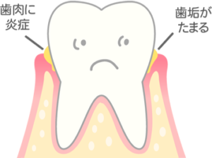 清藤歯科医院－歯周病治療