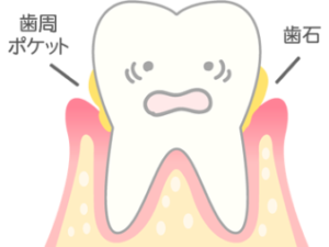 清藤歯科医院－歯周病治療