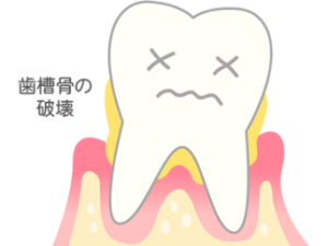 清藤歯科医院－歯周病治療