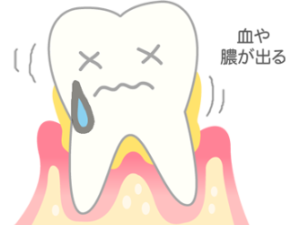 清藤歯科医院－歯周病治療