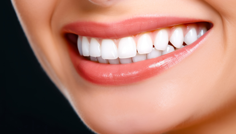 清藤歯科医院－ホワイトニング